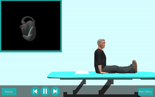 BPPV Treatment gif